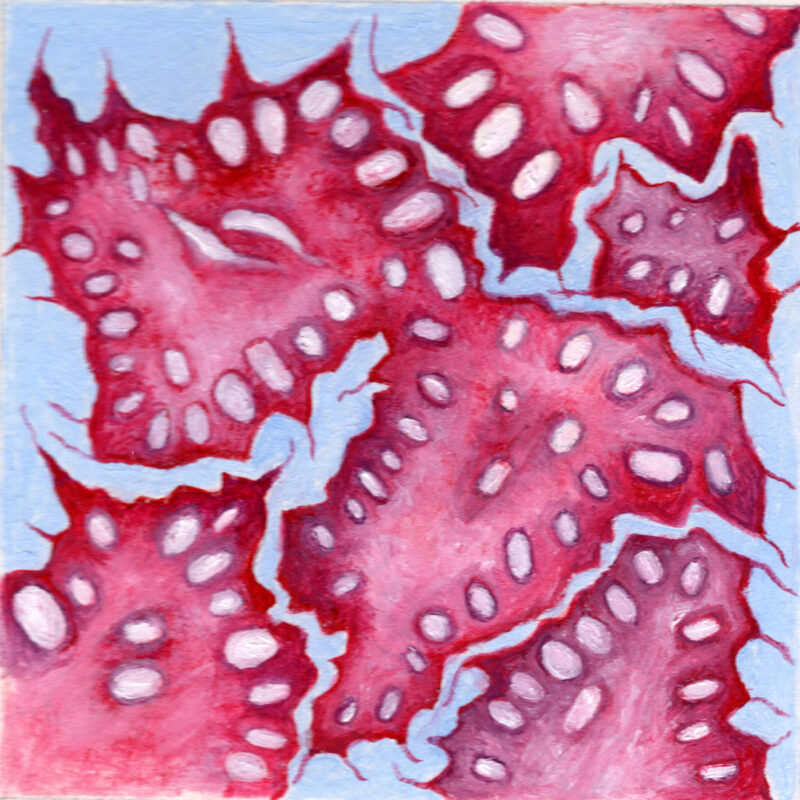 Papillary Thyroid Cancer